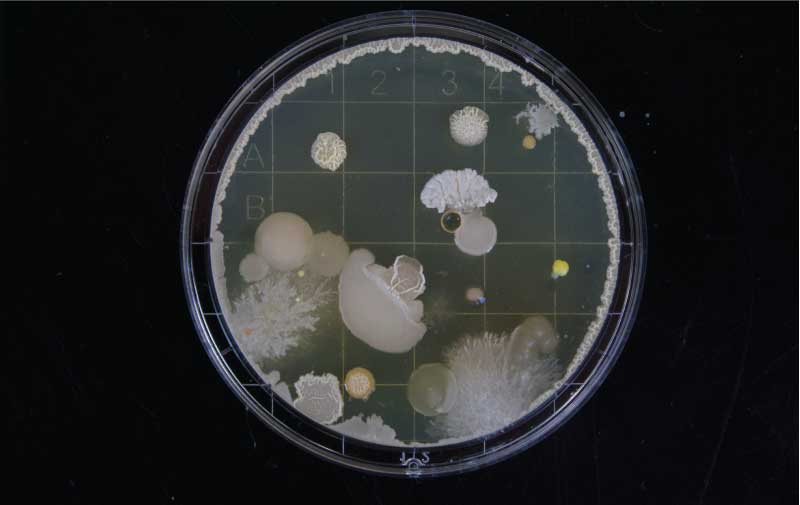 Mold Growing in a Petri Dish